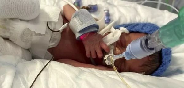 Bayi di area Inggris Lahir dengan Kulit Rapuh hingga Tak Bisa Digendong